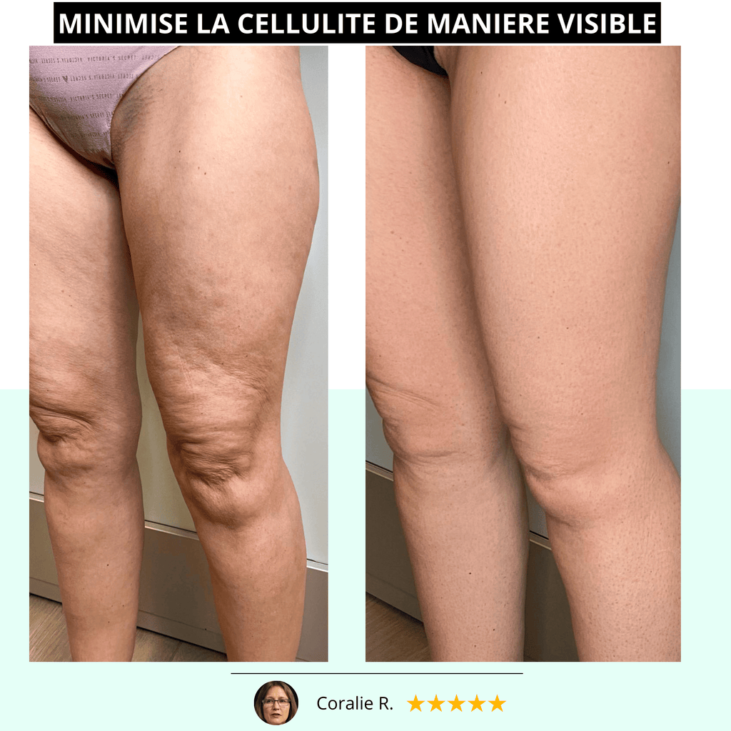 VIBRAPRO™️