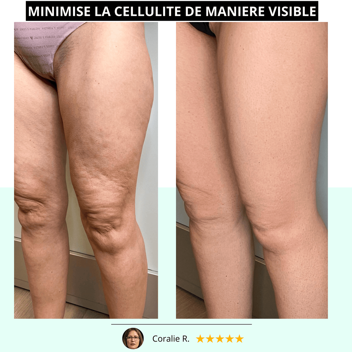 VIBRAPRO™️